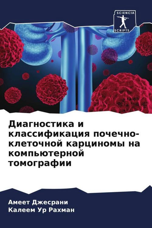 Produktbild: Diagnostika i klassifikaciq pochechno-kletochnoj karcinomy na komp'&uuml;ternoj tomografii