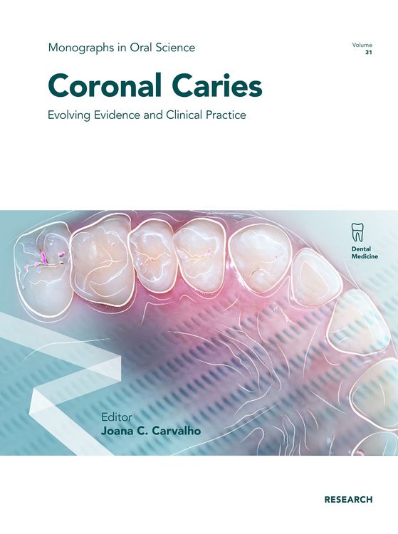 Produktbild: Coronal Caries