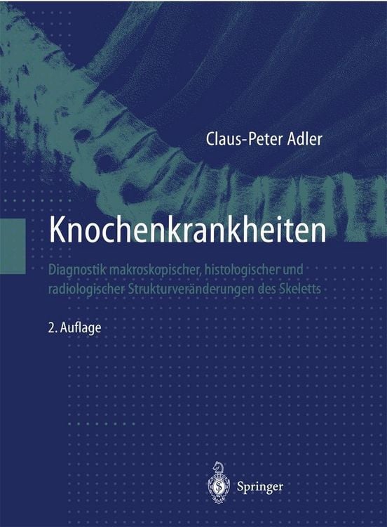 Produktbild: Knochenkrankheiten