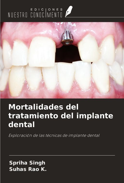 Produktbild: Mortalidades del tratamiento del implante dental