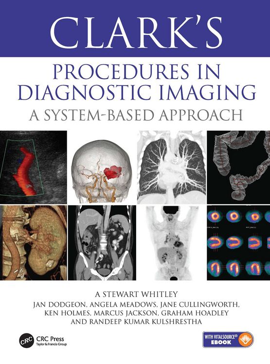 Produktbild: Clark's Procedures in Diagnostic Imaging