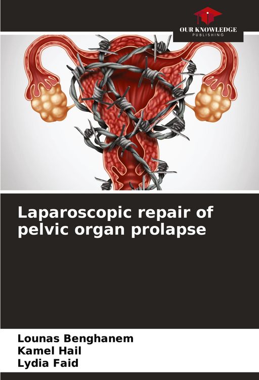 Produktbild: Laparoscopic repair of pelvic organ prolapse