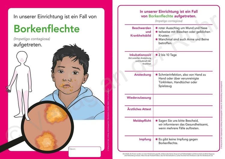 Produktbild: Erg&auml;nzungsset: Achtung, Ansteckungsgefahr! &ndash; 8 weitere Aush&auml;nge und Merkbl&auml;tter zu &uuml;bertragbaren Krankheiten
