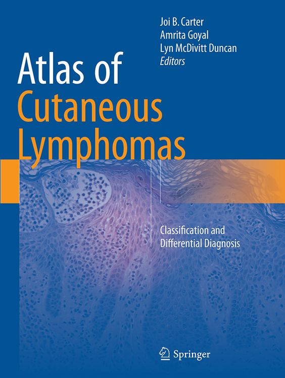 Produktbild: Atlas of Cutaneous Lymphomas