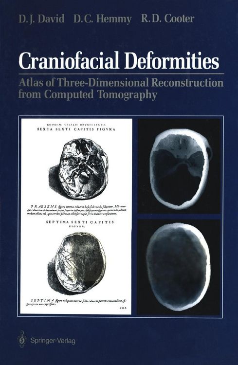Produktbild: Craniofacial Deformities