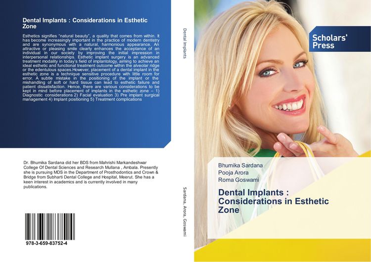 Produktbild: Dental Implants : Considerations in Esthetic Zone