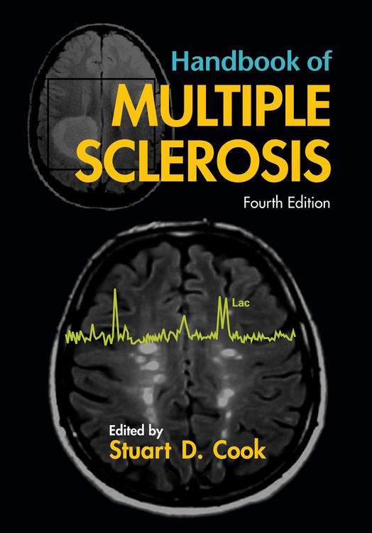 Produktbild: Handbook of Multiple Sclerosis
