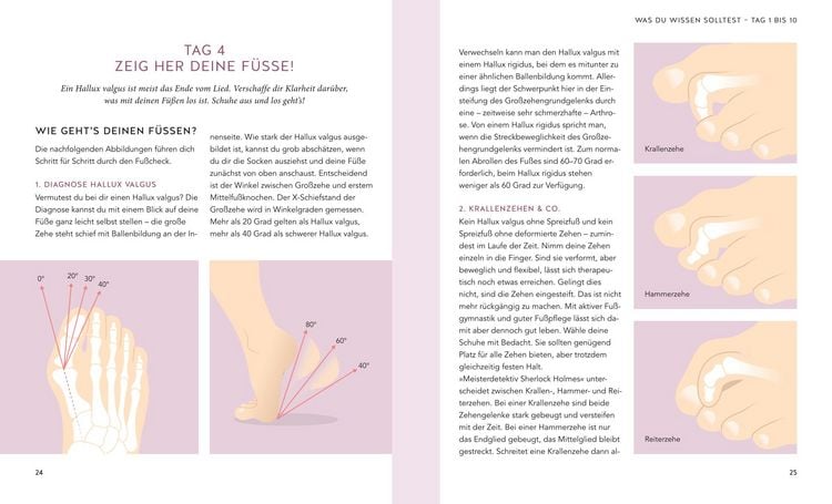Produktbild: Hallux valgus