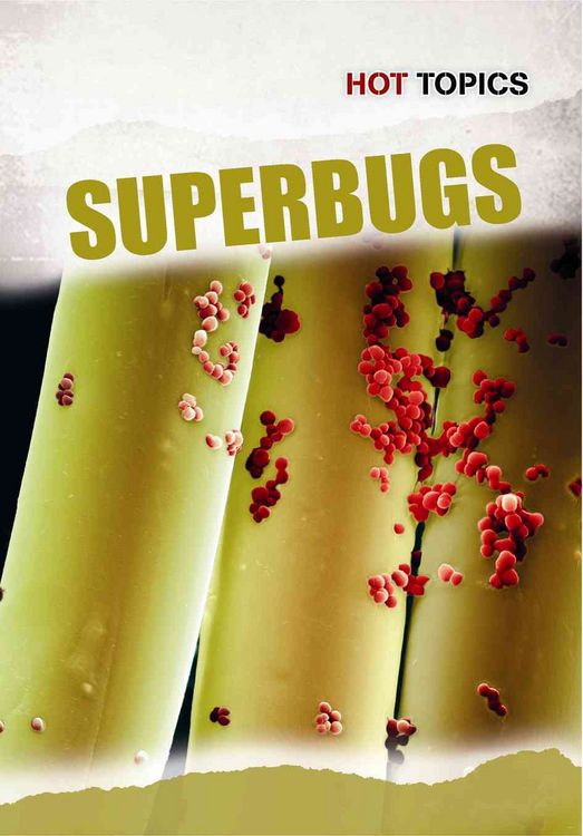 Produktbild: Hot Topics Superbugs
