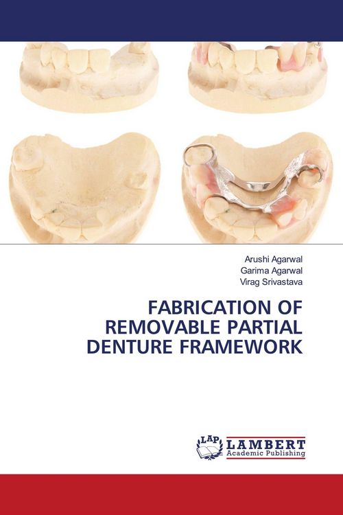 Produktbild: Fabrication Of Removable Partial Denture Framework