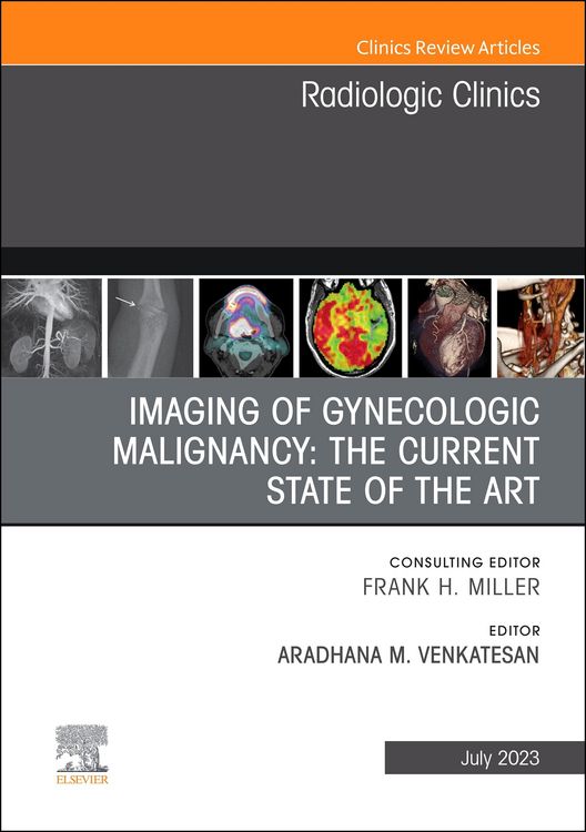 Produktbild: Imaging of Gynecologic Malignancy: The Current State of the Art, An Issue of Radiologic Clinics of North America, E-Book