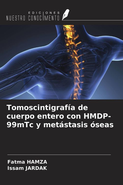 Produktbild: Tomoscintigraf&iacute;a de cuerpo entero con HMDP-99mTc y met&aacute;stasis &oacute;seas