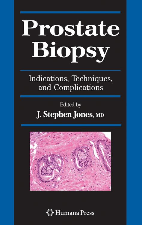 Produktbild: Prostate Biopsy