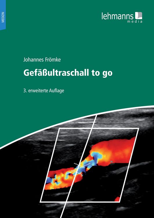 Produktbild: Gef&auml;&szlig;ultraschall to go