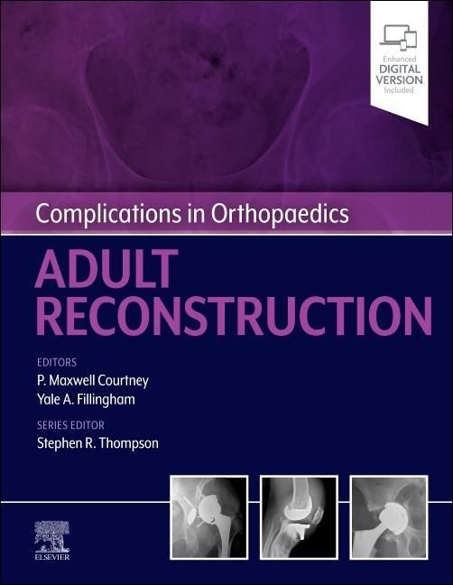 Produktbild: Complications in Orthopaedics: Adult Reconstruction