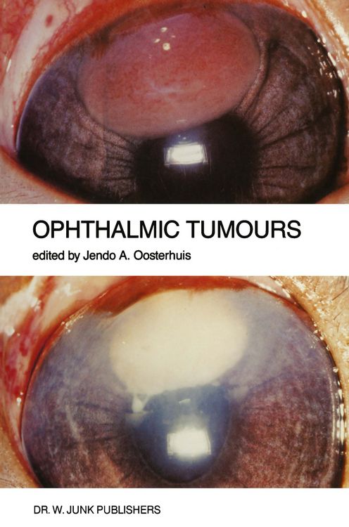 Produktbild: Ophthalmic Tumours