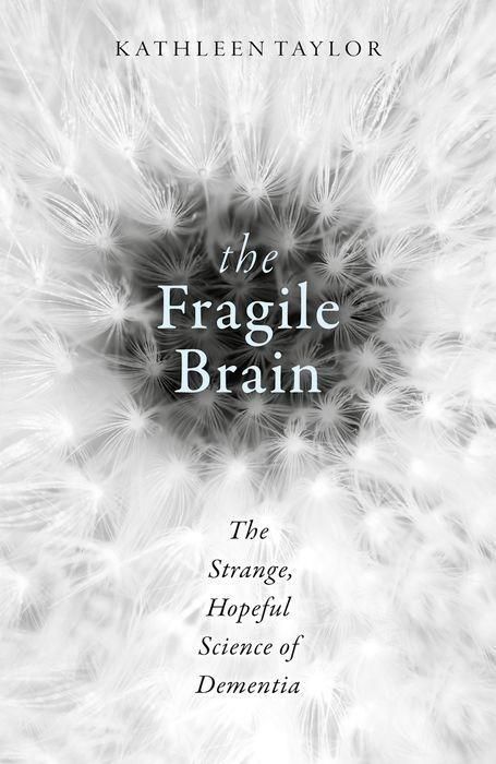 Produktbild: The Fragile Brain