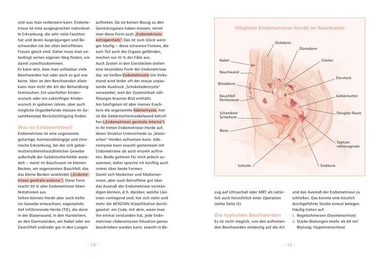 Produktbild: Endometriose &ndash; Was tun?
