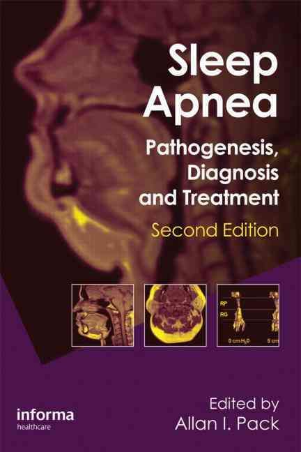 Produktbild: Sleep Apnea
