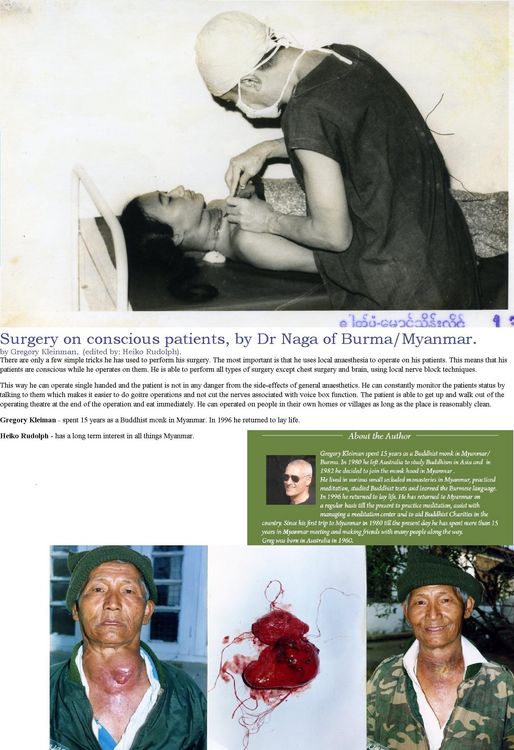 Produktbild: Surgery On Conscious Patients by Dr Naga of Burma