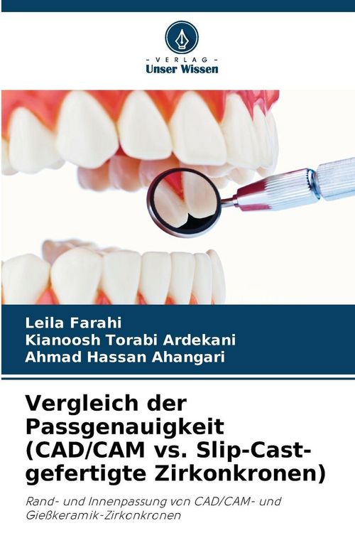 Produktbild: Vergleich der Passgenauigkeit (CAD/CAM vs. Slip-Cast-gefertigte Zirkonkronen)