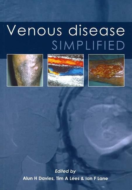 Produktbild: Venous Disease Simplified
