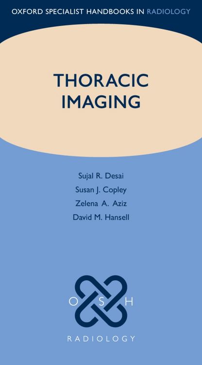 Produktbild: Thoracic Imaging