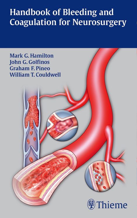 Produktbild: Handbook of Bleeding and Coagulation for Neurosurgery