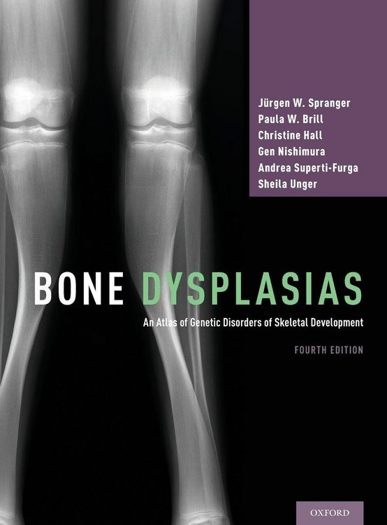 Produktbild: Bone Dysplasias