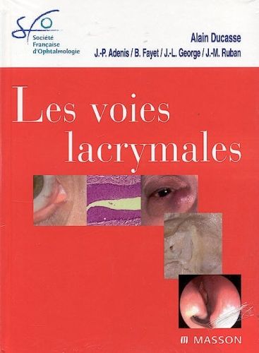 Produktbild: Les Voies Lacrymales Sfo (Edition 2006)