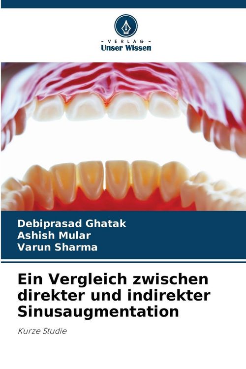Produktbild: Ein Vergleich zwischen direkter und indirekter Sinusaugmentation