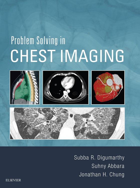 Produktbild: Problem Solving in Chest Imaging E-Book