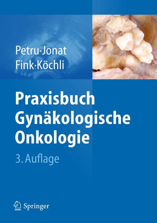 Produktbild: Praxisbuch Gyn&auml;kologische Onkologie