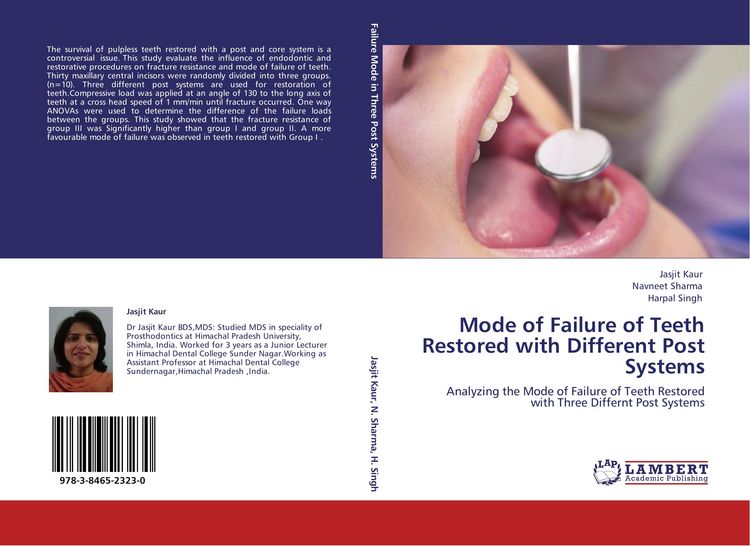 Produktbild: Mode of Failure of Teeth Restored with Different Post Systems
