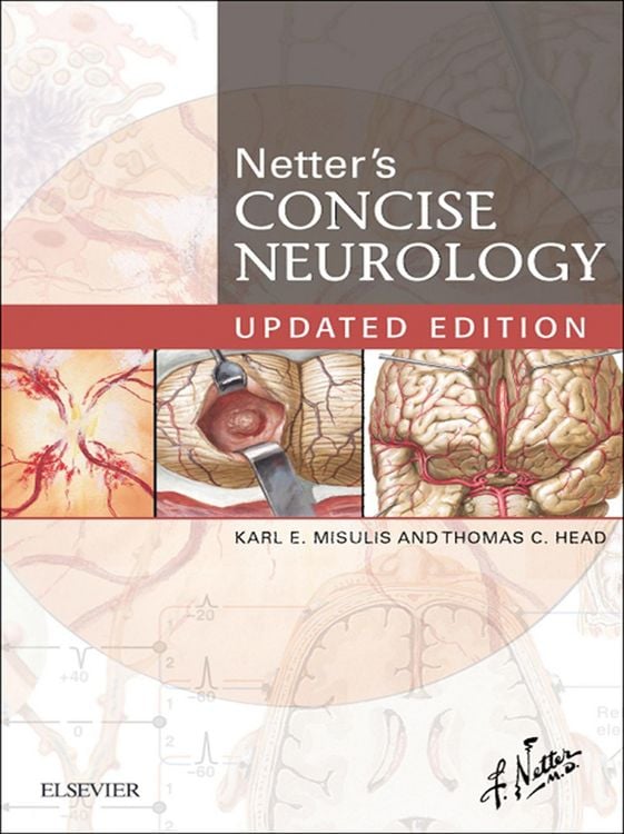 Produktbild: Netter's Concise Neurology Updated Edition E-Book