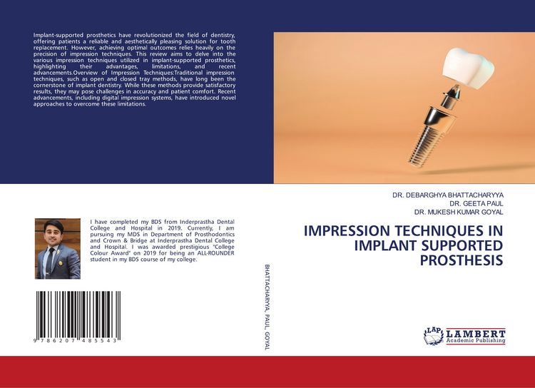 Produktbild: Impression Techniques in Implant Supported Prosthesis