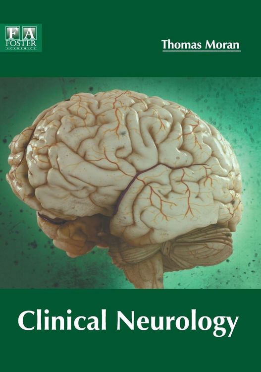 Produktbild: Clinical Neurology