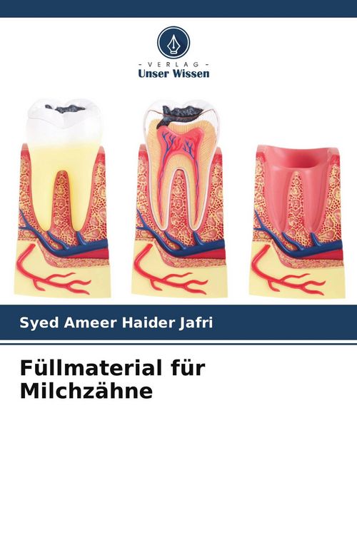 Produktbild: F&uuml;llmaterial f&uuml;r Milchz&auml;hne