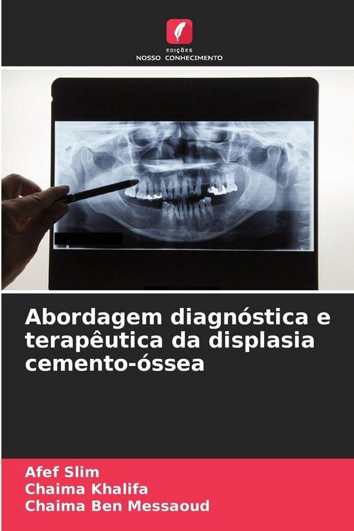 Produktbild: Abordagem diagn&oacute;stica e terap&ecirc;utica da displasia cemento-&oacute;ssea