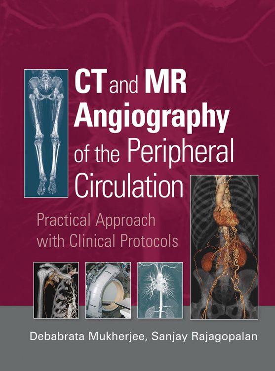 Produktbild: CT and MR Angiography of the Peripheral Circulation