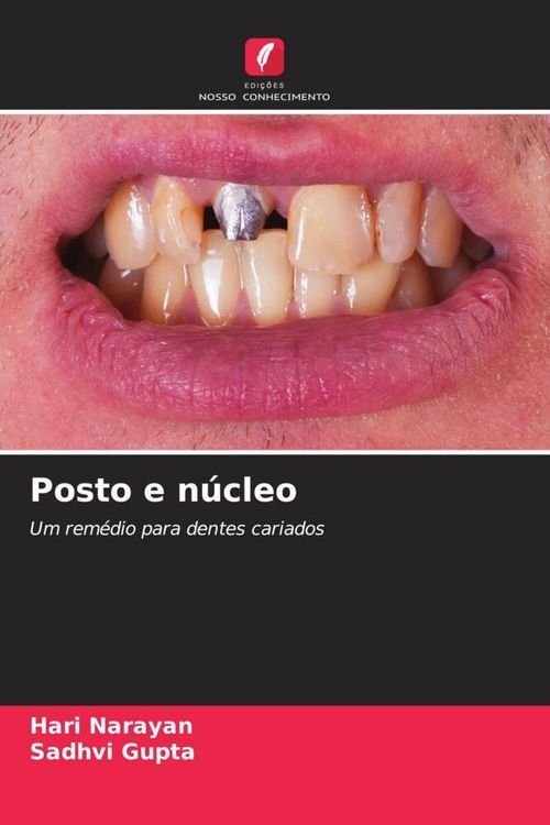 Produktbild: Posto e n&uacute;cleo