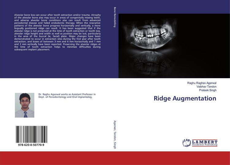 Produktbild: Ridge Augmentation