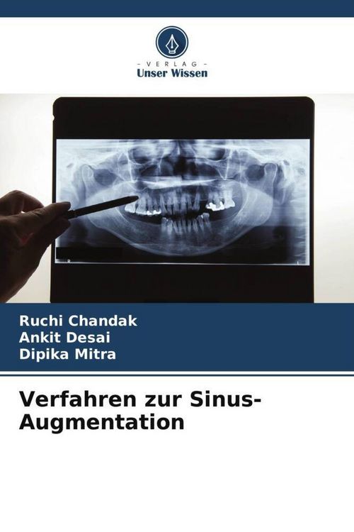 Produktbild: Verfahren zur Sinus-Augmentation