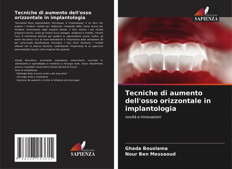 Produktbild: Tecniche di aumento dell'osso orizzontale in implantologia