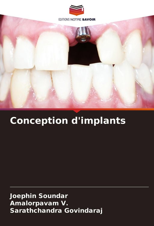 Produktbild: Conception d'implants
