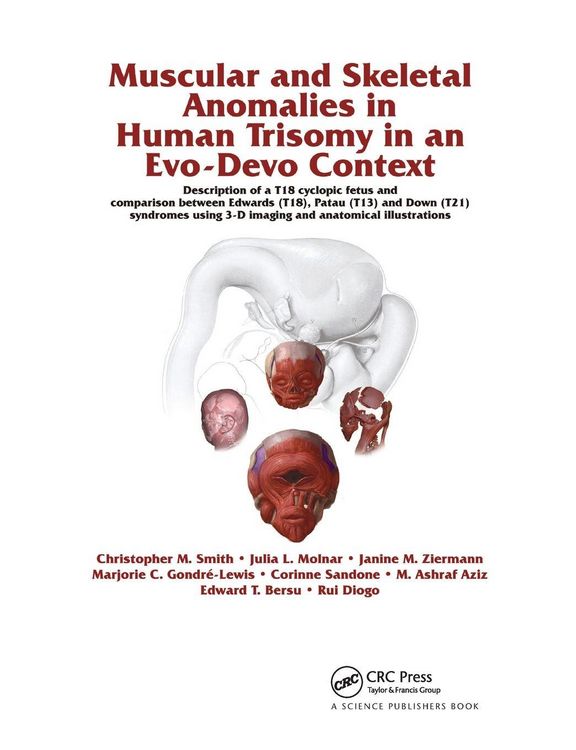 Produktbild: Muscular and Skeletal Anomalies in Human Trisomy in an Evo-Devo Context
