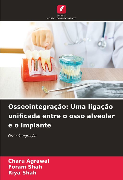 Produktbild: Osseointegra&ccedil;&atilde;o: Uma liga&ccedil;&atilde;o unificada entre o osso alveolar e o implante