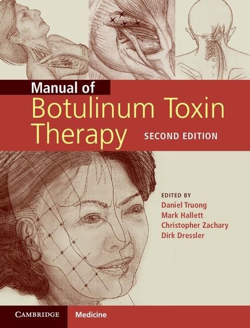 Produktbild: Manual of Botulinum Toxin Therapy