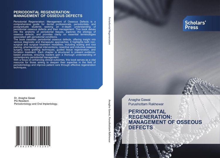 Produktbild: Periodontal Regeneration: Management Of Osseous Defects