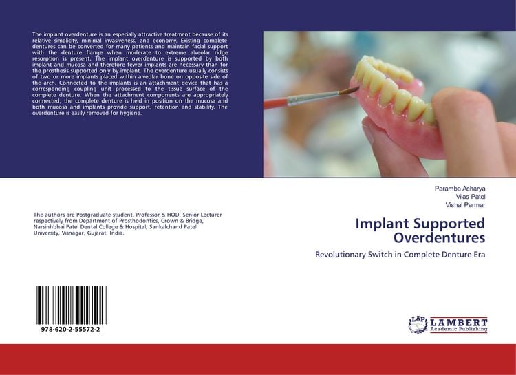 Produktbild: Implant Supported Overdentures